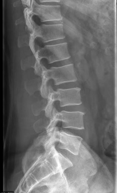I have lower back pain…should I go get scans? 